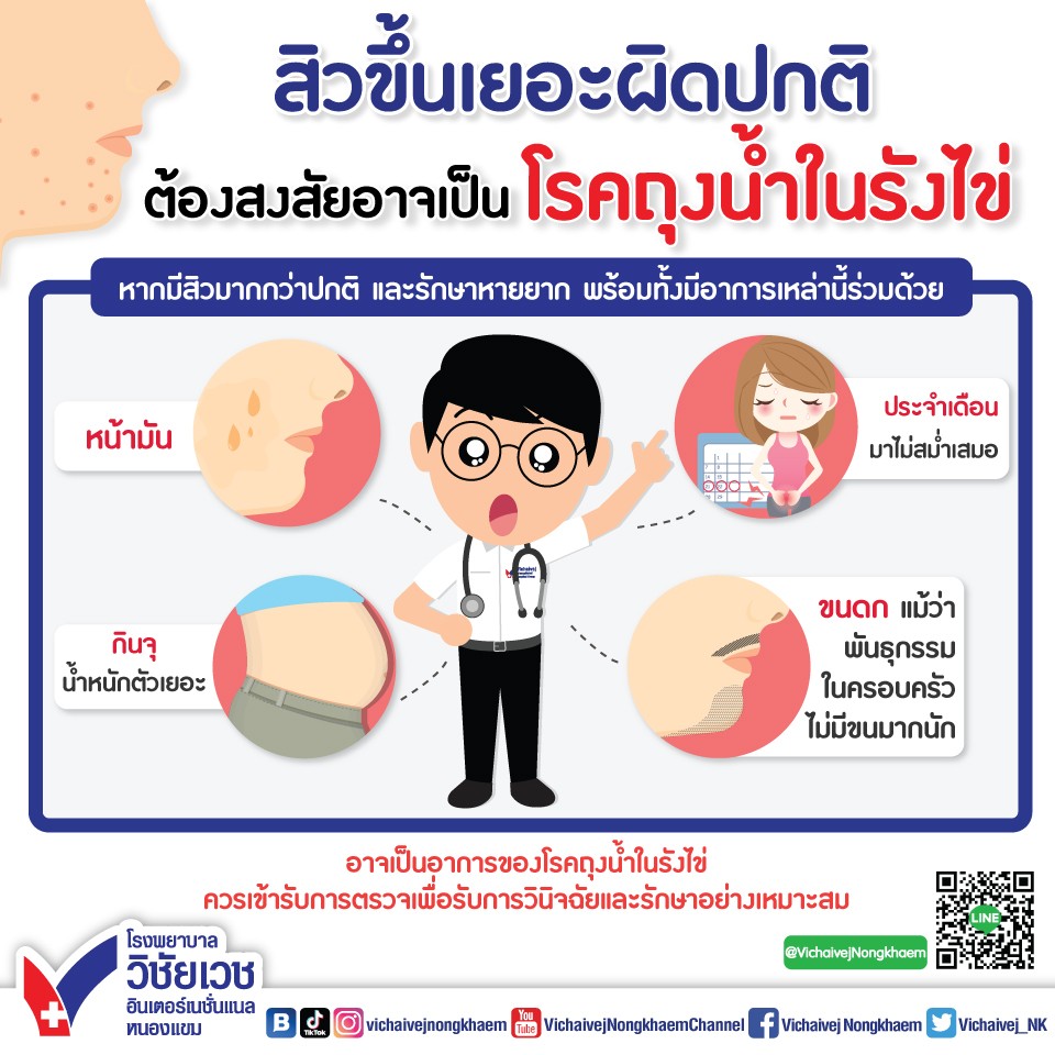 สิวขึ้นเยอะผิดปกติ ต้องสงสัยอาจเป็น โรคถุงน้ำในรังไข่