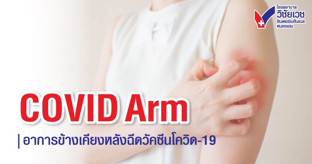 COVID Arm อาการข้างเคียงหลังฉีดวัคซีนโควิด-19