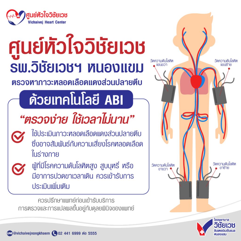 ศูนย์หัวใจวิชัยเวช รพ. วิชัยเวชฯ หนองแขม ตรวจหาภาวะหลอดเลือดแดงส่วนปลายตีบ ด้วยเทคโนโลยี ABI