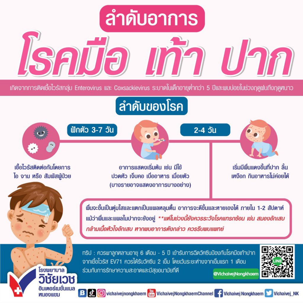 ลำดับอาการโรคมือเท้าปาก