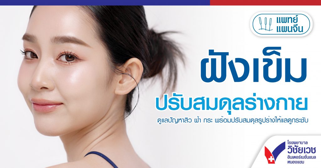 ฝังเข็มปรับสมดุลร่างกาย