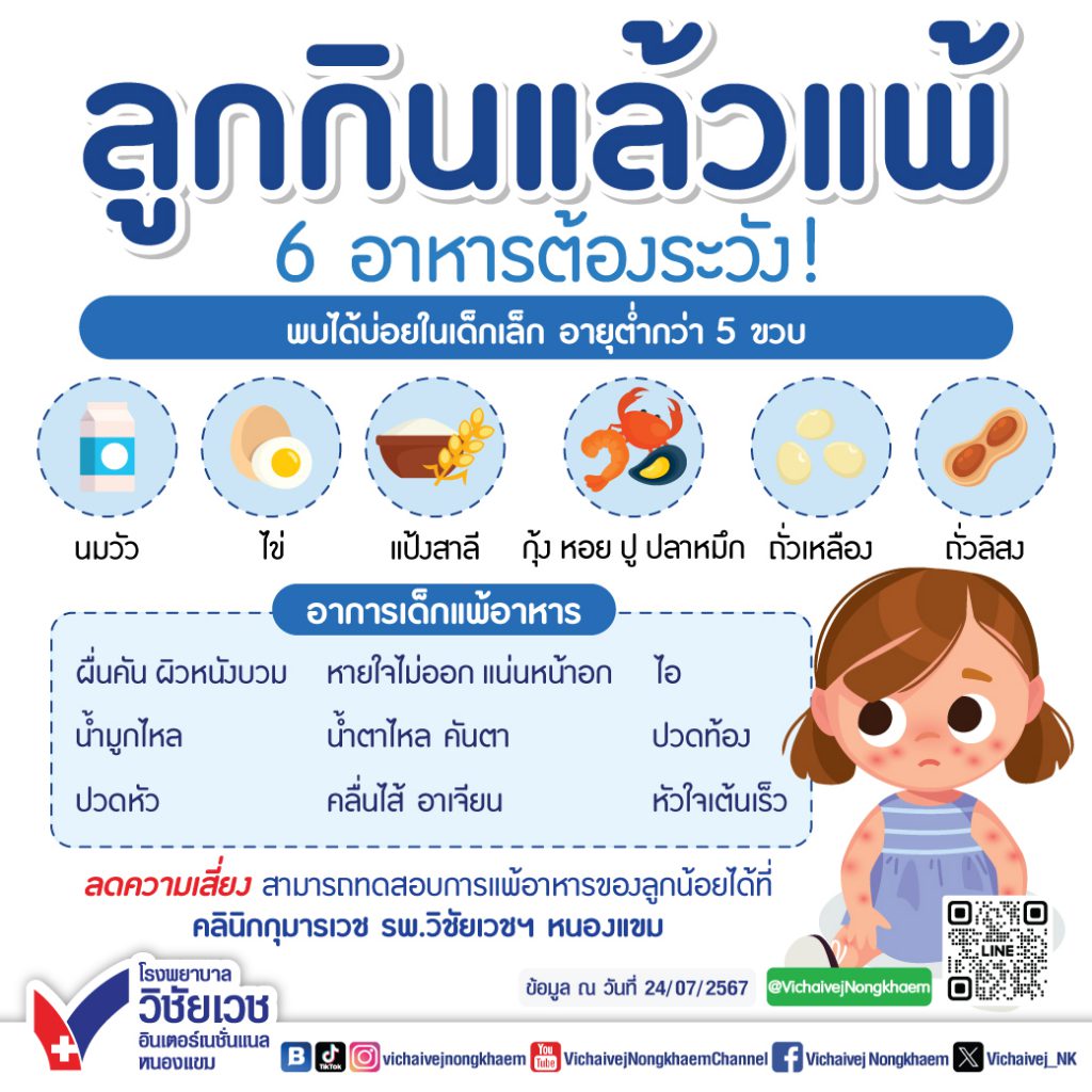 ลูกกินแล้วแพ้ 6 อาหารต้องระวัง