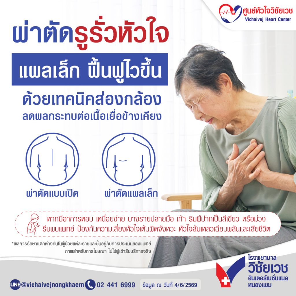 ผ่าตัดรูรั่วหัวใจ แผลเล็ก ฟื้นฟูไวขึ้น ด้วยเทคนิคส่องกล้อง