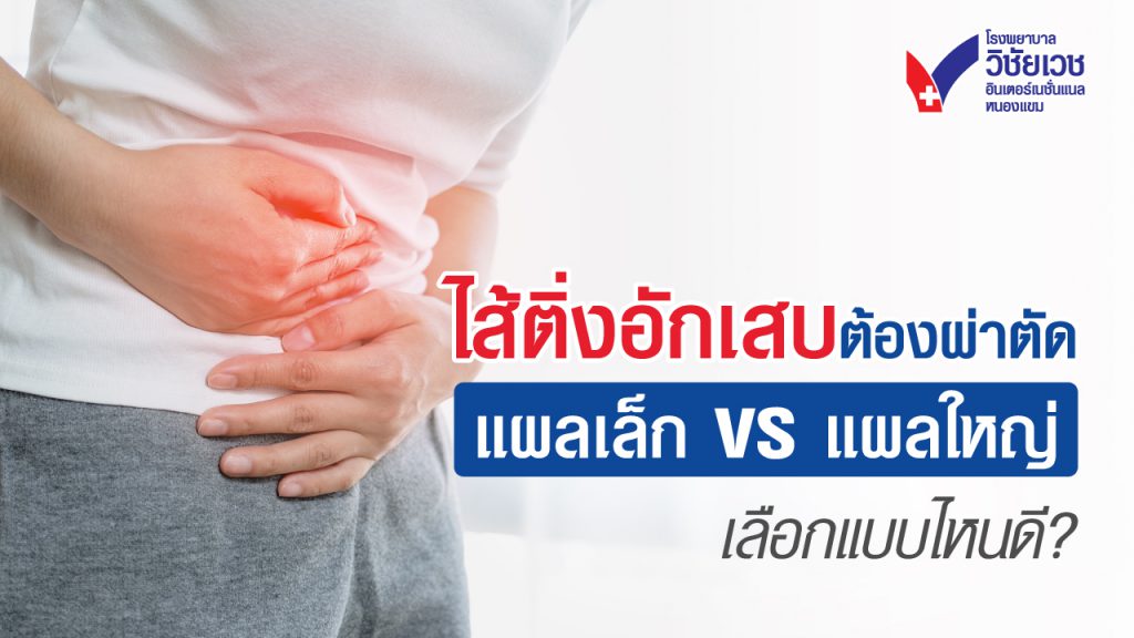 ไส้ติ่งอักเสบต้องผ่าตัด! แผลเล็ก vs แผลใหญ่ เลือกแบบไหนดี?