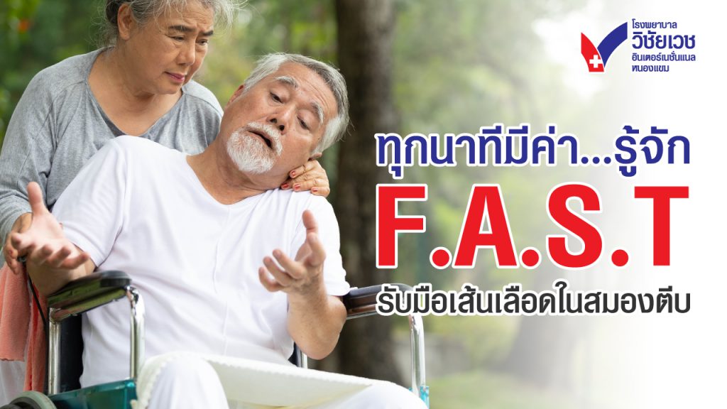 ทุกนาทีมีค่า..รู้จัก F.A.S.T รับมือเส้นเลือดในสมองตีบ