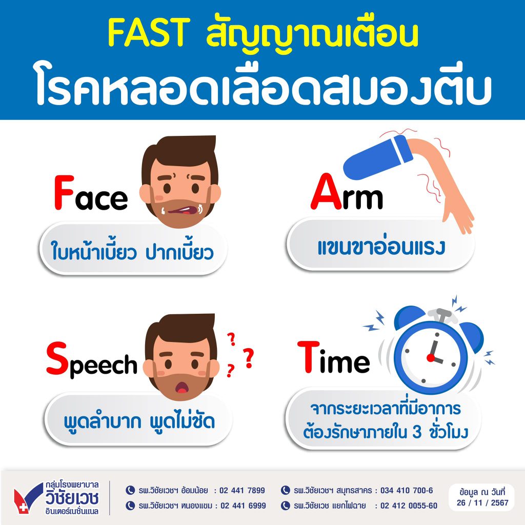 FAST สัญญาณเตือนโรคหลอดเลือดสมองตีบ