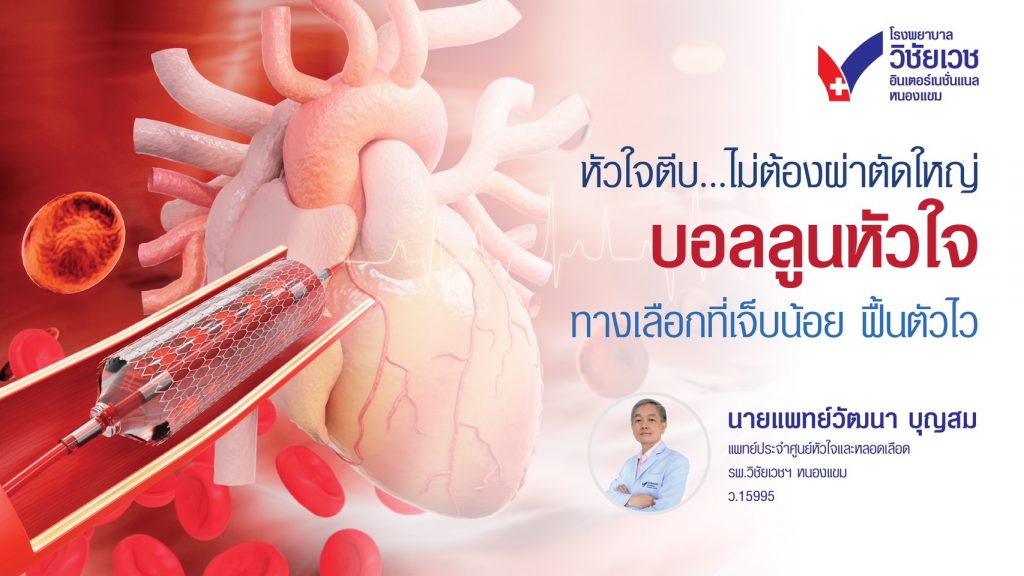 บอลลูนหัวใจคืออะไร?  ทางเลือกการรักษาหลอดเลือดหัวใจแบบไม่ต้องผ่าตัด
