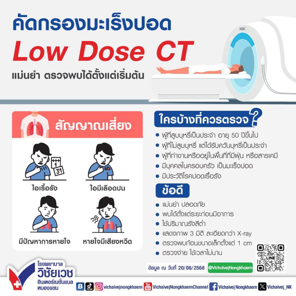 คัดกรองมะเร็งปอด Low Dose CT แม่นยำ ตรวจพบได้ตั้งแต่เริ่มต้น
