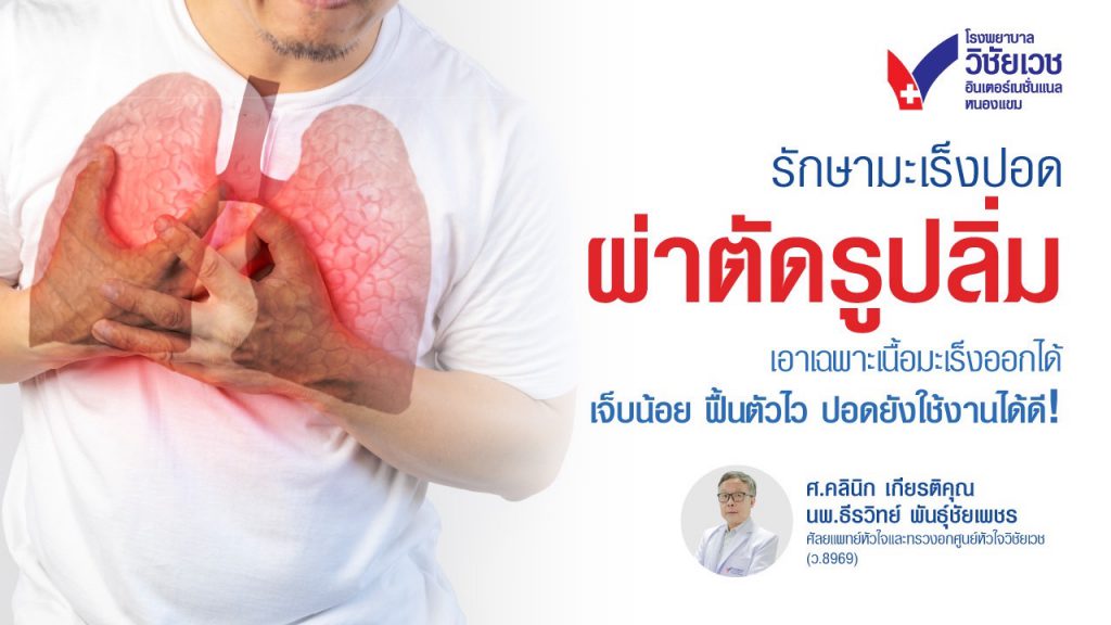 รักษามะเร็งปอด…ไม่ต้องตัดปอดเยอะ!  ผ่าตัดรูปลิ่มคืออะไร?
