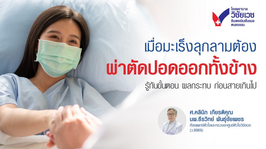 เมื่อมะเร็งลุกลามต้องผ่าตัดปอดออกทั้งข้าง (Pneumonectomy): รู้ทันขั้นตอน และผลกระทบ ก่อนสายเกินไป