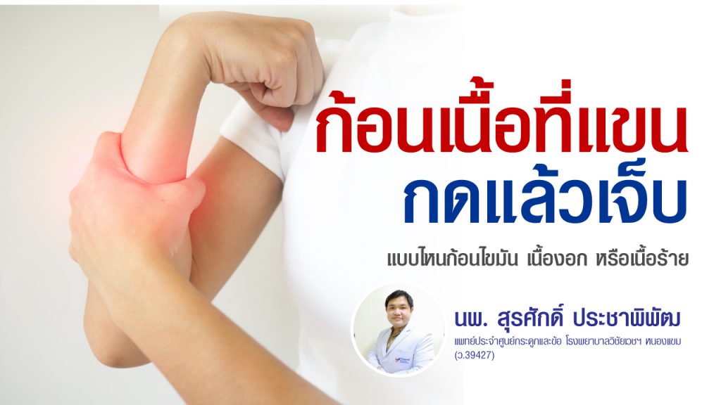 ก้อนเนื้อที่แขน กดแล้วเจ็บหรือไม่เจ็บ อันตรายไหม? วิธีแยกเนื้องอกไขมัน เนื้องอก เนื้อร้าย และสัญญาณที่ควรพบแพทย์