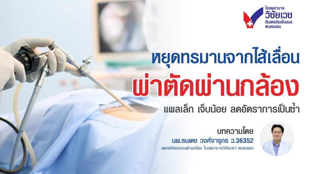 ผ่าตัดไส้เลื่อนผ่านกล้องข้อดีคืออะไร? แผลเล็ก ฟื้นตัวเร็ว เจ็บน้อยจริงไหม
