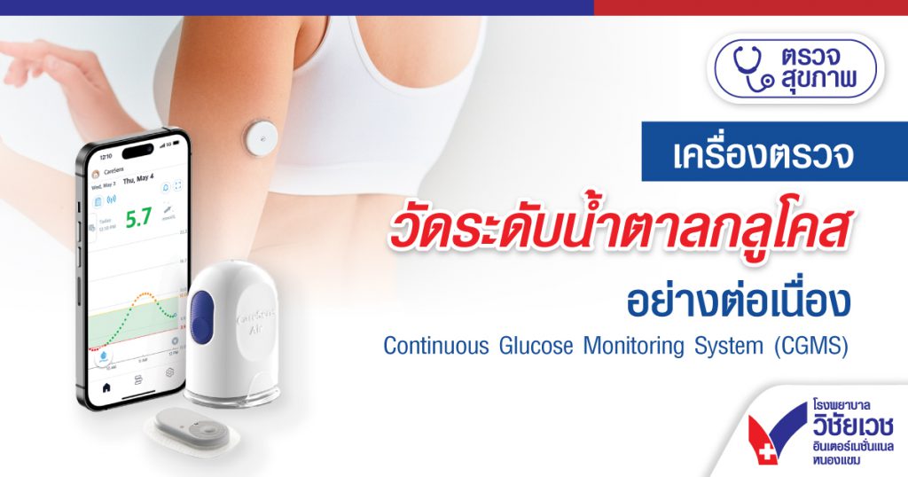 เครื่องตรวจวัดระดับน้ำตาลกลูโคสอย่างต่อเนื่อง
