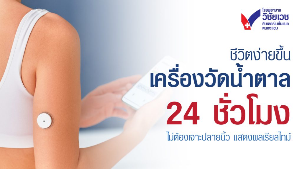 CGM เครื่องวัดระดับน้ำตาลแบบต่อเนื่อง 24 ชม. แสดงผลเรียลไทม์ ไม่เจ็บ ไม่ยุ่งยาก