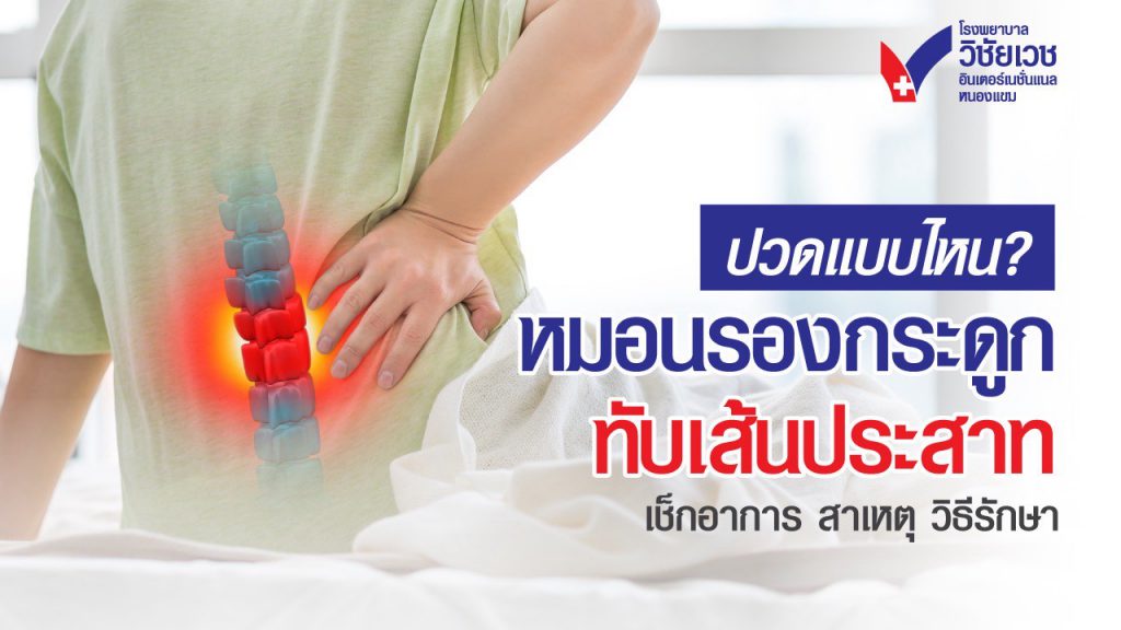 ปวดแบบไหน หมอนรองกระดูกทับเส้นประสาท เช็กอาการ สาเหตุและวิธีรักษา