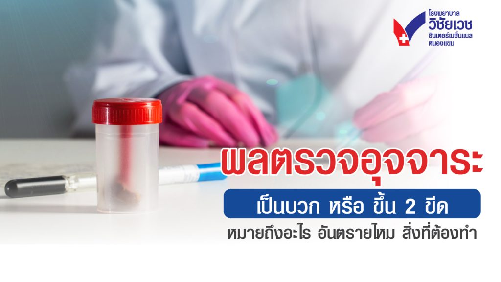 ผลตรวจอุจจาระเป็นบวก หรือขึ้น 2 ขีด หมายถึงอะไร อันตรายไหม สิ่งที่ต้องทำ