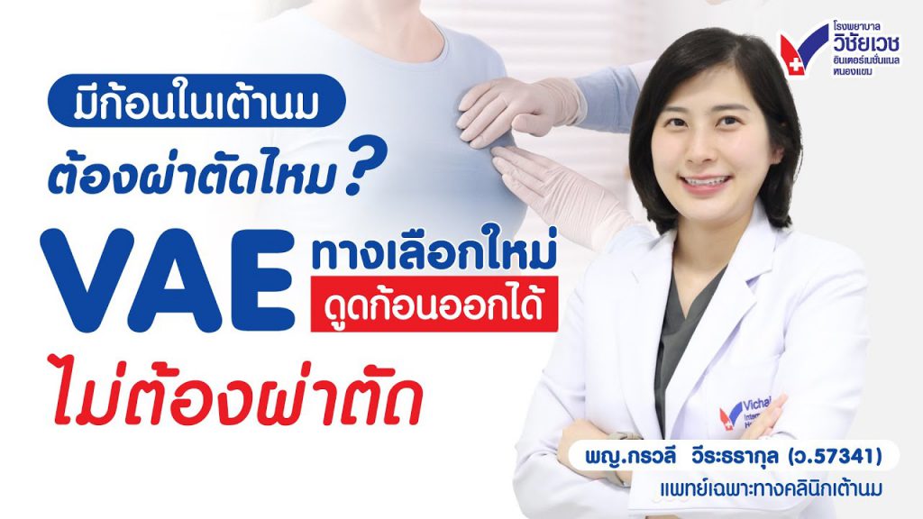 ก้อนในเต้านม ต้องผ่าตัดทุกเคสไหม? รู้จัก VAE ดูดก้อนเต้านมออกได้ ไม่ต้องผ่าตัด