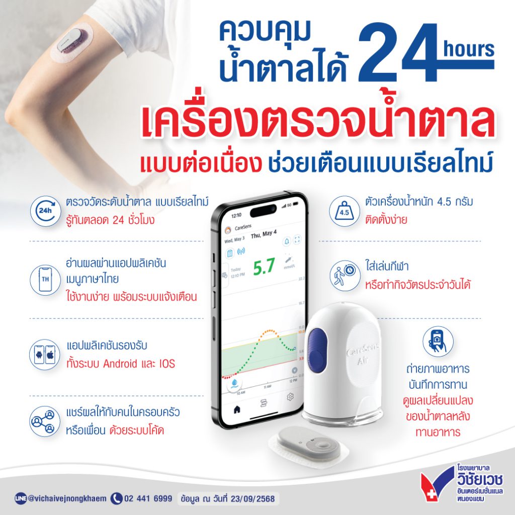 เครื่องตรวจน้ำตาลแบบต่อเนื่อง ช่วยเตือนแบบเรียลไทม์ ควบคุมน้ำตาลได้ 24 ชั่วโมง