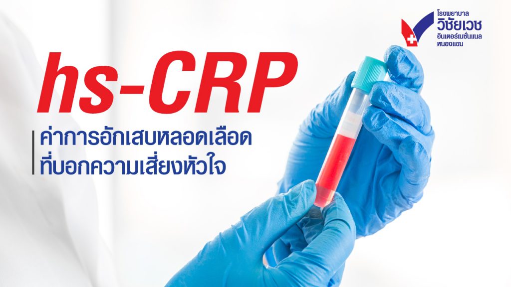 hs-CRP คืออะไร? ค่าการอักเสบของเลือดที่บอกความเสี่ยงโรคหัวใจ