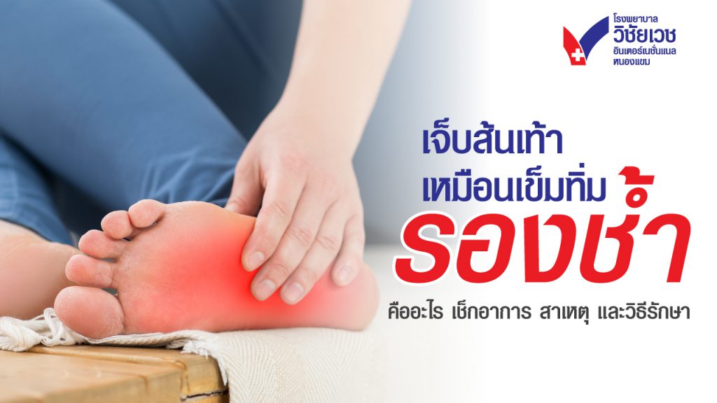 โรครองช้ำคืออะไร? อาการ สาเหตุ และวิธีรักษา