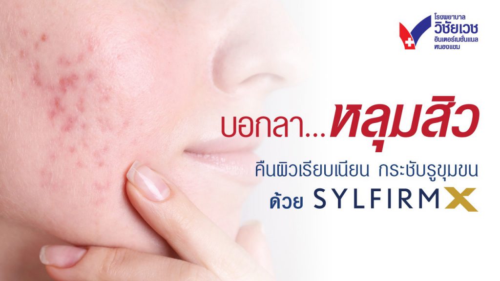 บอกลา “หลุมสิว” คืนผิวเรียบเนียน กระชับรูขุมขน ด้วย Sylfirm X Plus
