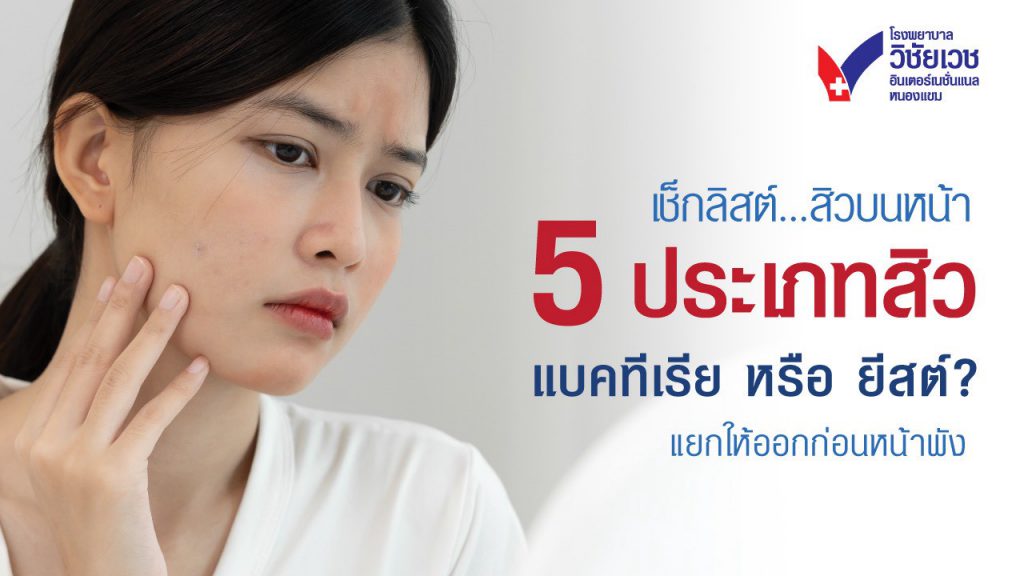 สิวที่เป็นอยู่คือ “สิวเชื้อรา” หรือ “แบคทีเรีย”? เช็กลิสต์ 5 ประเภทสิว อาการคัน ตุ่มนูน แตกต่างกันอย่างไร พร้อมแนวทางการรักษาที่ถูกต้องจากแพทย์ผิวหนัง อ่านเลย