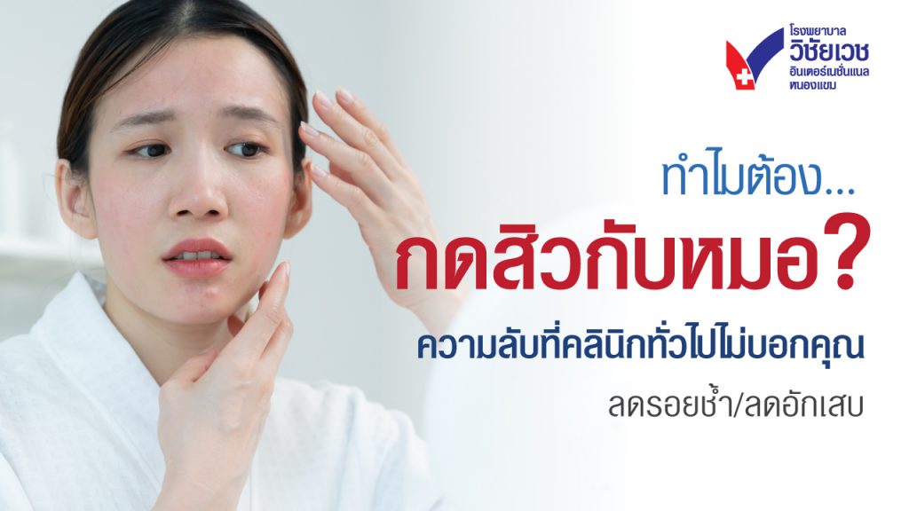 ทำไมต้อง 