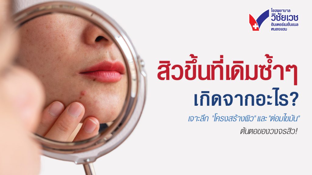 สิวขึ้นที่เดิมซ้ำๆ เกิดจากอะไร? เจาะลึกต้นตอ 