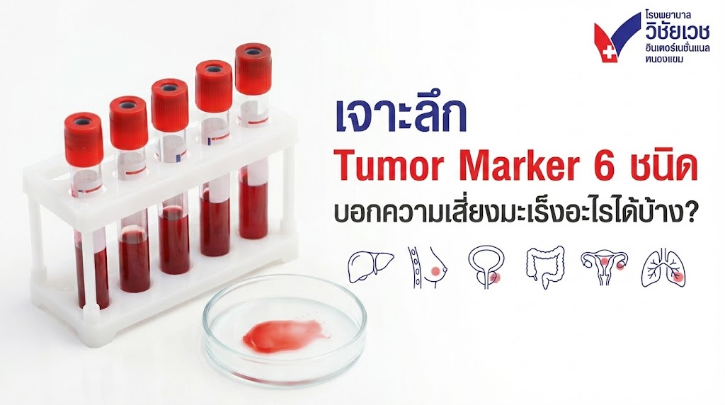 เจาะลึก Tumor Marker 6 ชนิด: ตรวจสารบ่งชี้มะเร็งบอกความเสี่ยงอะไรได้บ้าง? (ฉบับปี 2026)