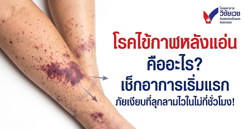 โรคไข้กาฬหลังแอ่น คืออะไร? เช็กอาการเริ่มแรก ภัยเงียบที่ลุกลามไวในไม่กี่ชั่วโมง!