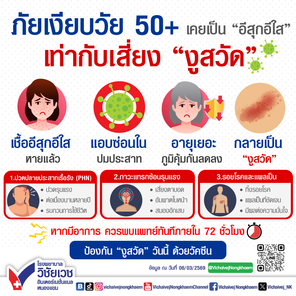 ภันเงียบวัย50+ เคยเป็นอีสุกอีใส เท่ากับเสี่ยง “งูสวัด”