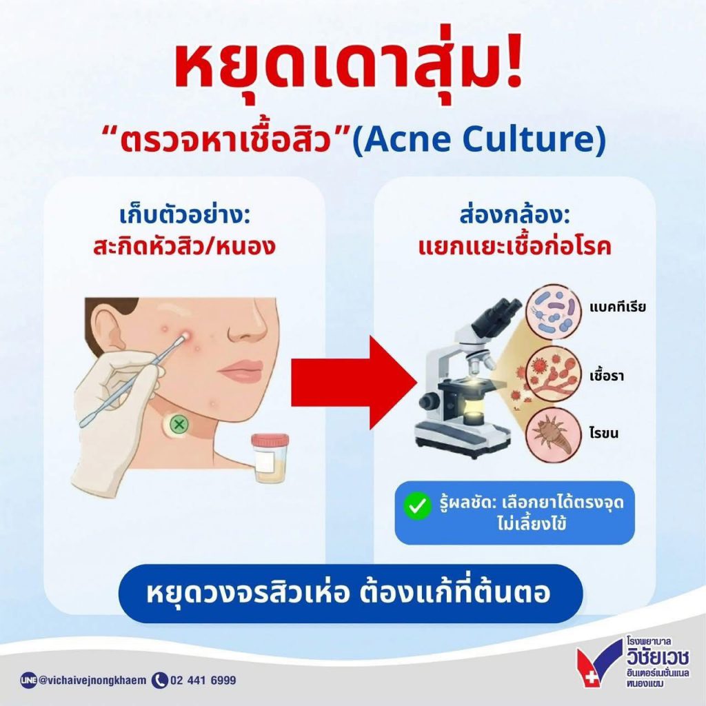 หยุดเดาสุ่ม! ตรวจหาเชื้อสิว