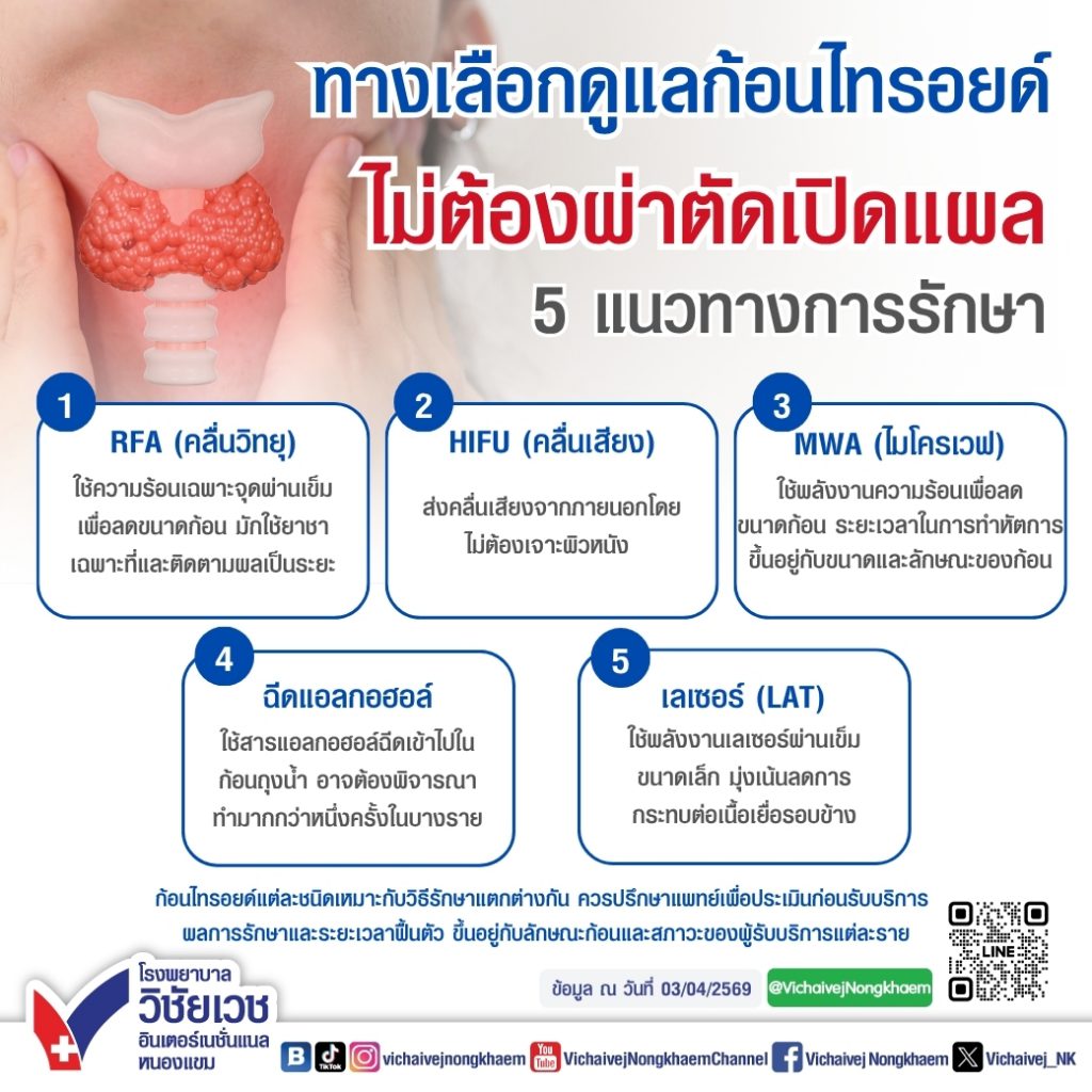 ทางเลือกดูแลก้อนไทรอยด์
