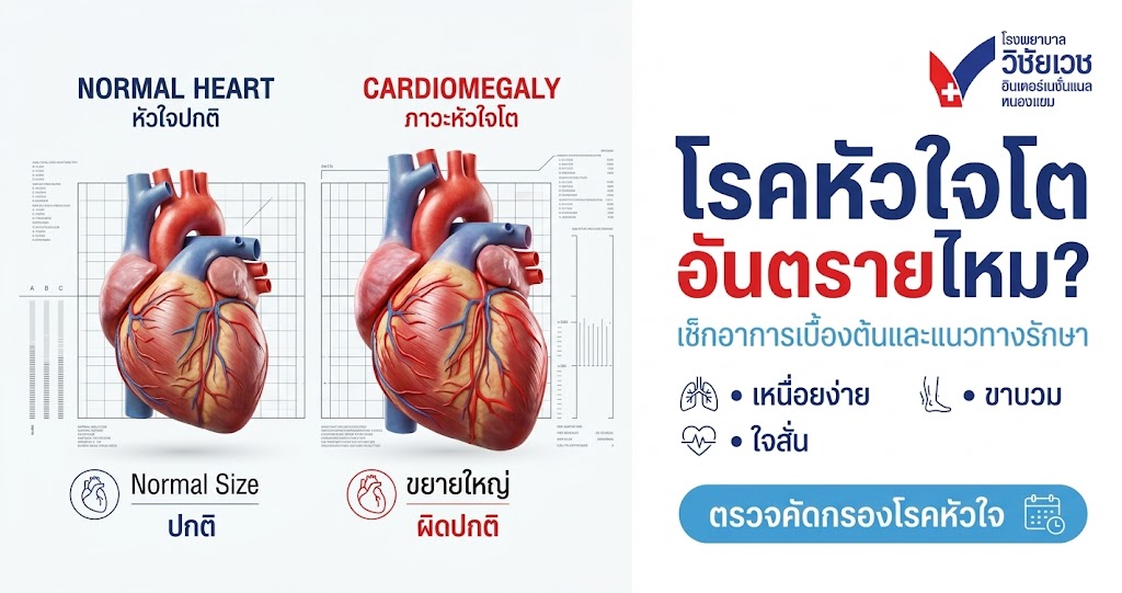 โรคหัวใจโต อันตรายไหม? เช็กอาการเบื้องต้นและแนวทางรักษา เพื่อหัวใจที่แข็งแรง