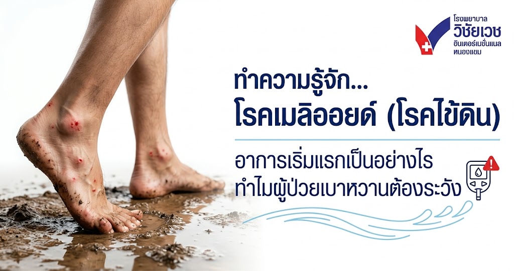เช็กด่วน! โรคเมลิออยด์ (โรคไข้ดิน) อาการเริ่มแรกเป็นอย่างไร ทำไมผู้ป่วยเบาหวานต้องระวังเป็นพิเศษ