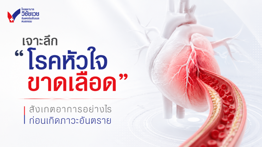 เจาะลึก