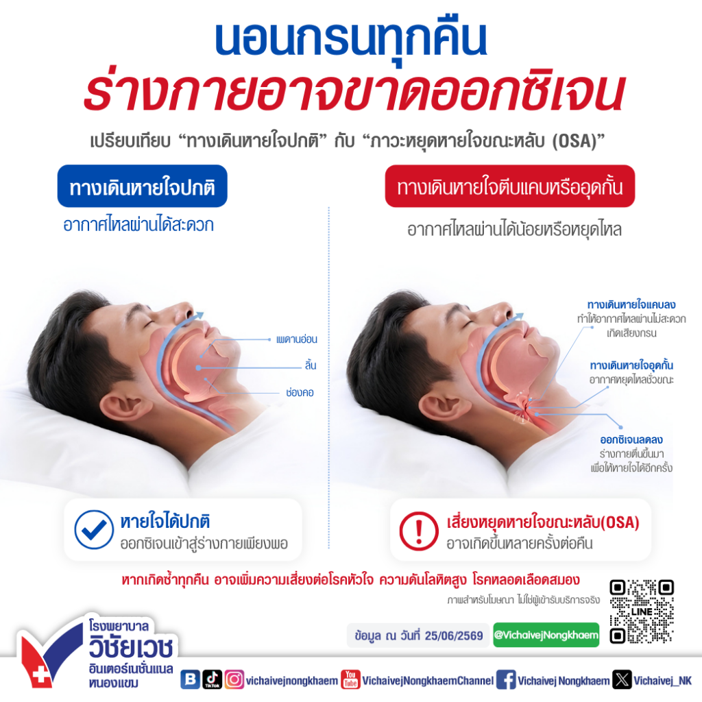นอนกรนทุกคืนร่างกายอาจขาดออกซิเจน