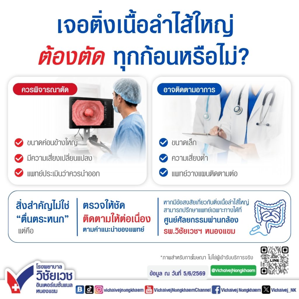 เจอติ่งเนื้อลำไส้ใหญ่ ต้องตัดทุกก้อนหรือไม่?