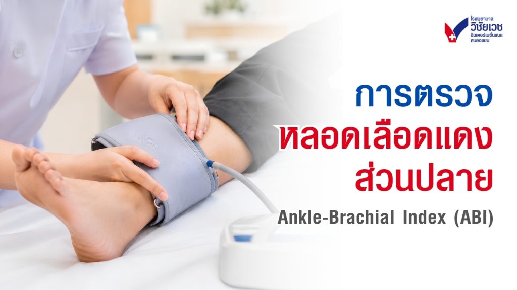 การตรวจหลอดเลือดแดงส่วนปลาย Ankle-Brachial Index (ABI)