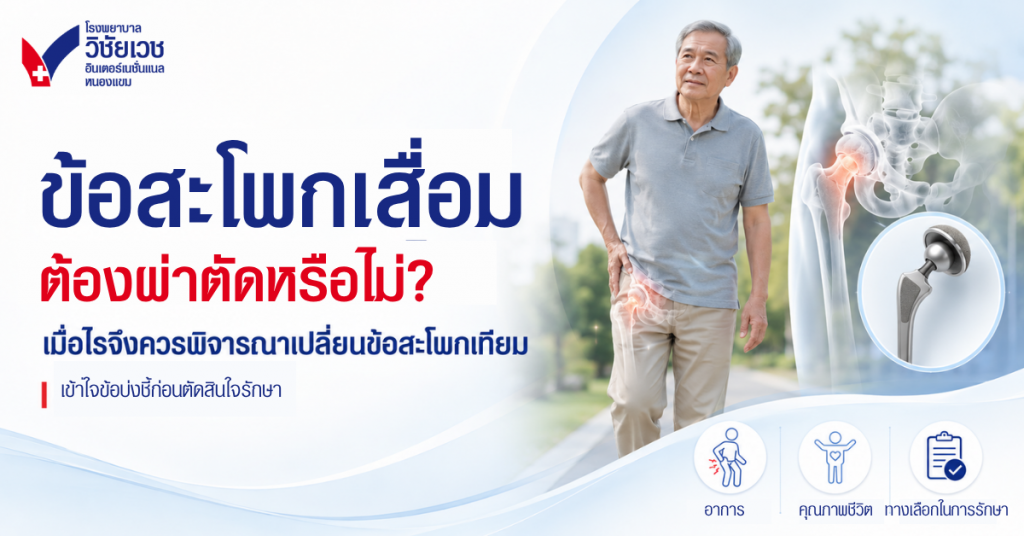 ข้อสะโพกเสื่อมต้องผ่าตัดหรือไม่? เมื่อไรจึงควรพิจารณาเปลี่ยนข้อสะโพกเทียม