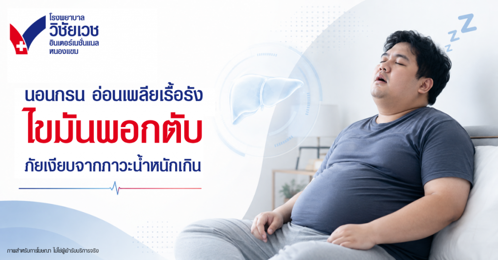 นอนกรน อ่อนเพลียเรื้อรัง ไขมันพอกตับ... ภัยเงียบจากภาวะน้ำหนักเกิน